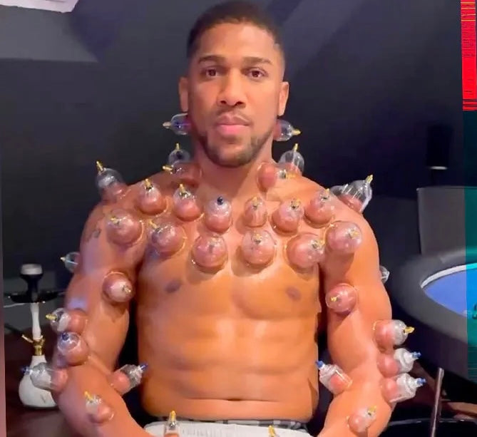 Anthony Joshua